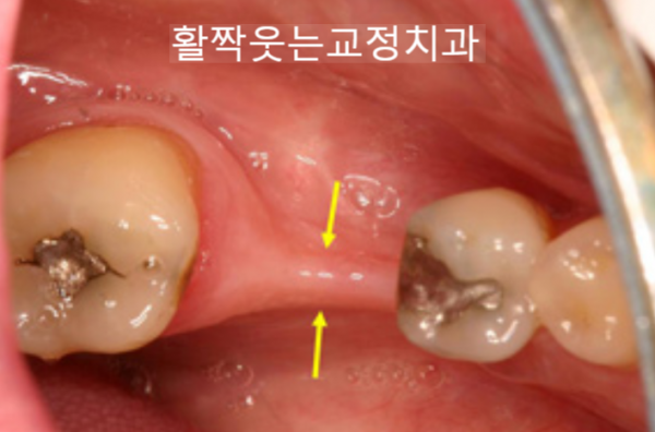 bfc430540201c23a2123ef35c36cb748_1599443160_0583.png