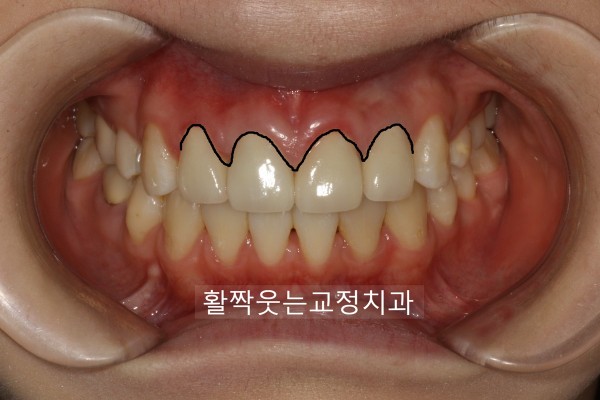 bfc430540201c23a2123ef35c36cb748_1599443197_1336.jpg