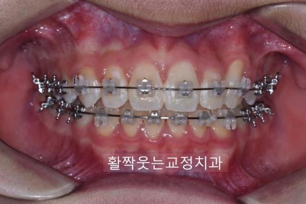 a62126acfb6799dcddd45567d9e00994_1610594695_9337.jpg